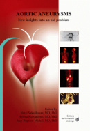 Aortic Aneurysms