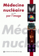 Médecine nucléaire par l'image